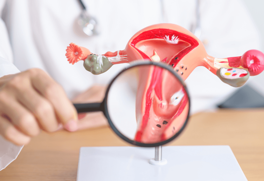 PCOS/PCOD program image