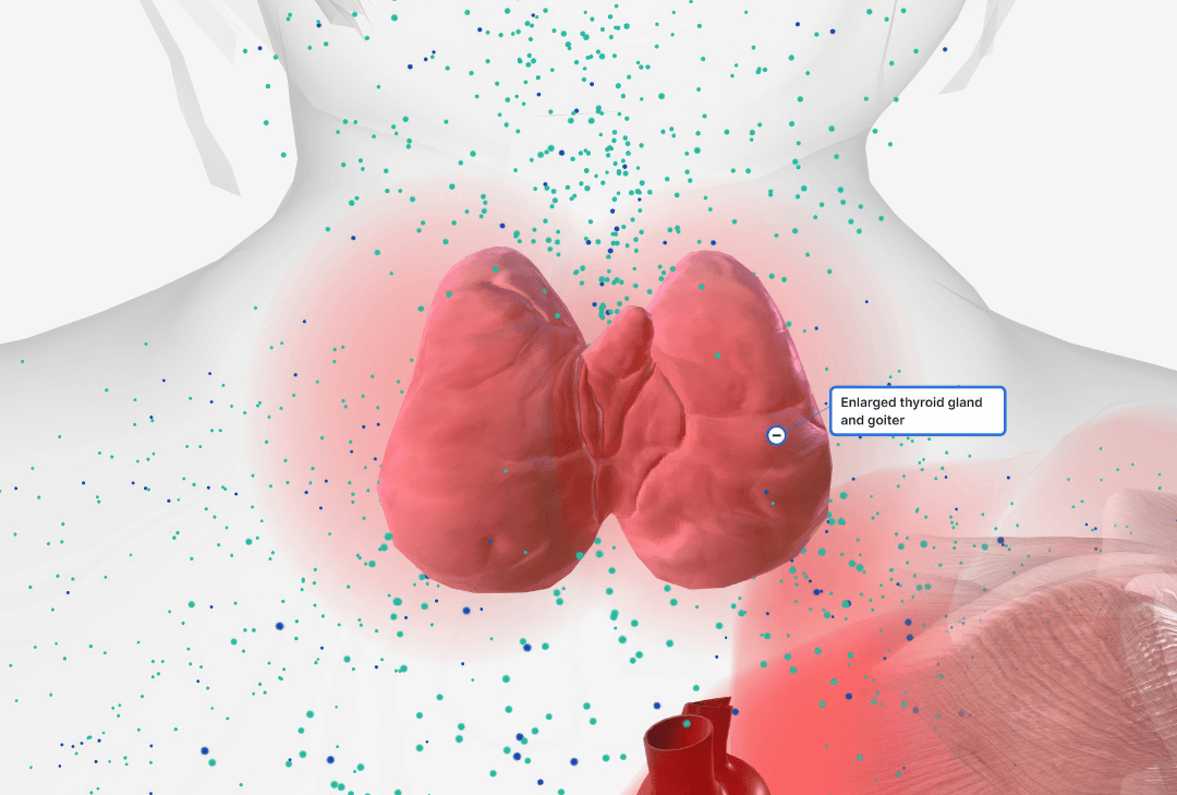 Thyroid Care program image